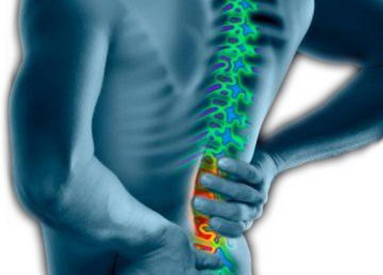 Bel Düzleşmesi Belirtileri ve Tedavisi